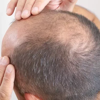 Safe G Cell Treatment in Dubai & Abu Dhabi | Glamorous Clinic in Dubai