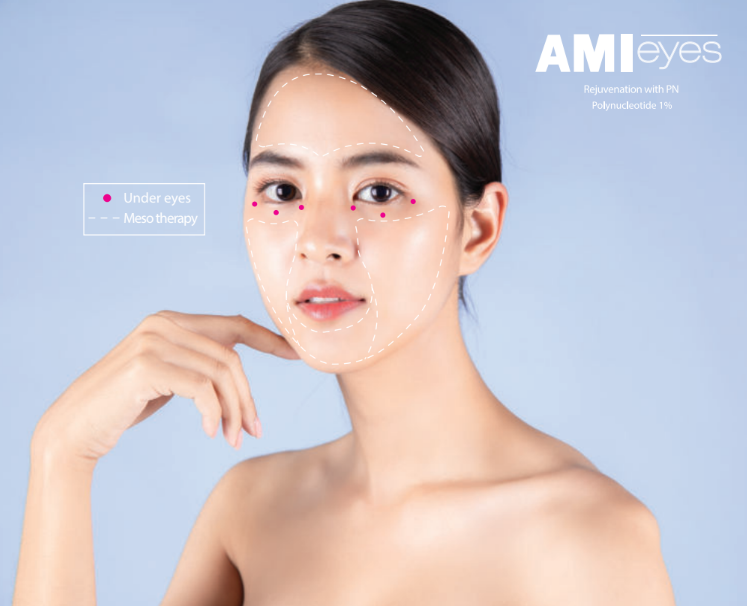 Ami Eyes with PN in Dubai & Abu Dhabi to Restore Youthful Eyes | Glamorous Clinic in Dubai