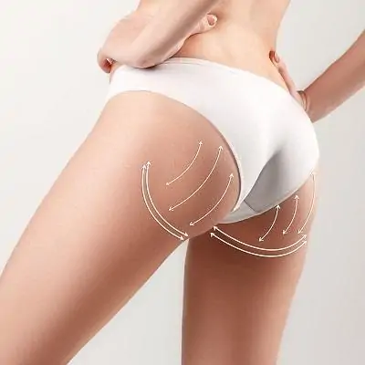 Brazilian Butt Lift for Fuller Shape Dubai & Abu Dhabi | Glamorous Clinic in Dubai