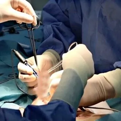 Reliable Circumcision Surgery in Dubai & Sharjah | Glamorous Clinic in Dubai