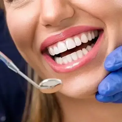 Customized E-Max Veneers in Dubai & Abu Dhabi | Glamorous Clinic Dubai