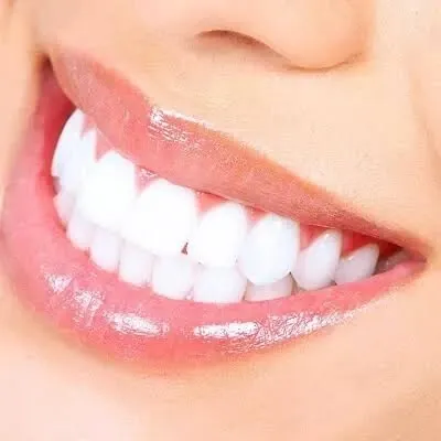 Cosmetic Teeth Whitening in Dubai & Abu Dhabi | Glamorous Clinic Dubai
