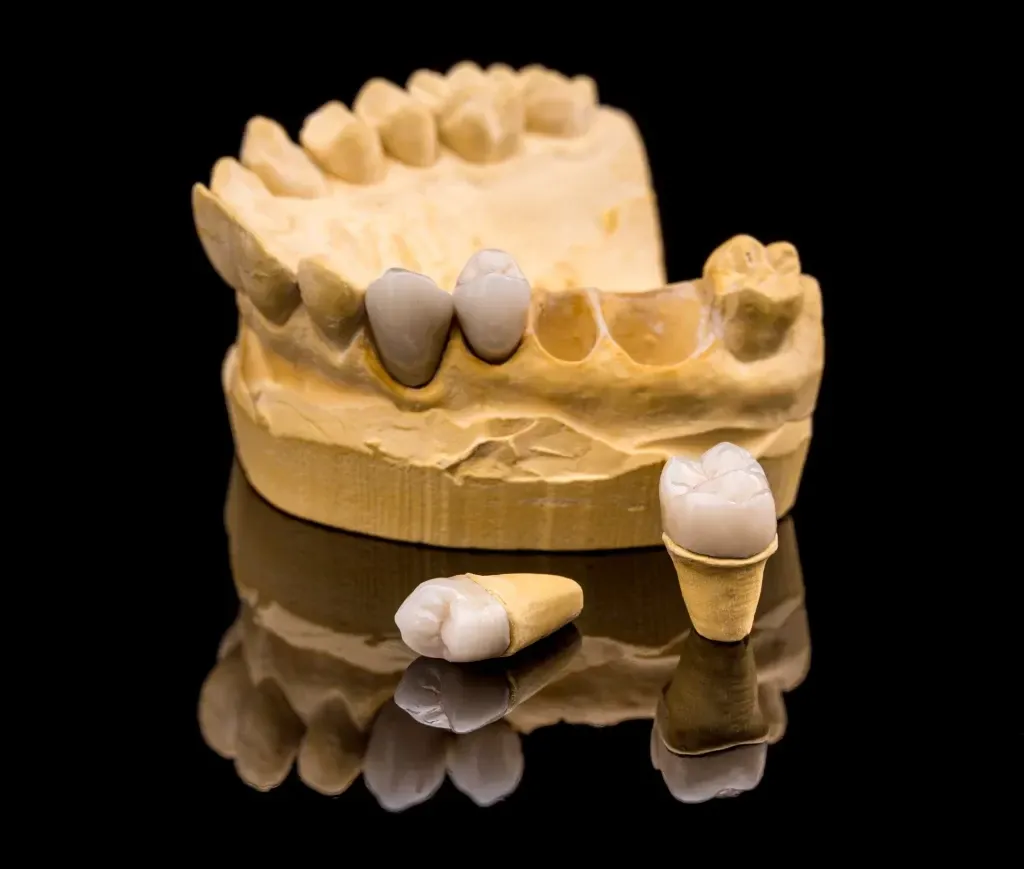 Zirconia Crown Dubai & Abu Dhabi for Damaged Tooth Repair | Glamorous Clinic Dubai