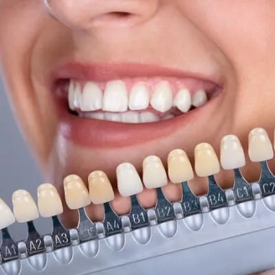 Dental Veneers in Dubai & Abu Dhabi: Choosing the Right Veneer Type | Glamorous Clinic Dubai